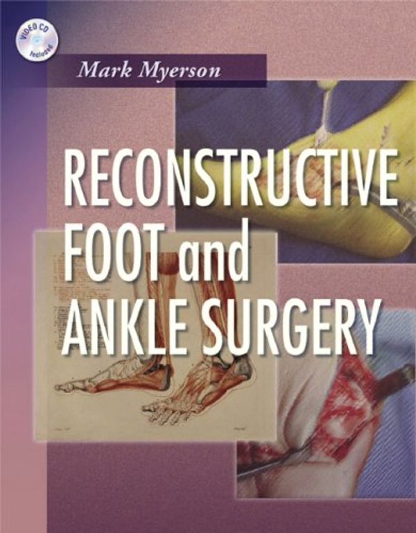 Cover Art for 9781416023586, Reconstructive Foot and Ankle Surgery by Mark S. Myerson