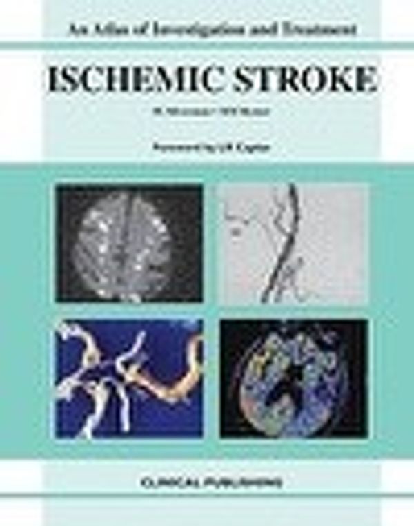 Cover Art for 9781846920172, Ischemic Stroke by Marilyn M. Rymer