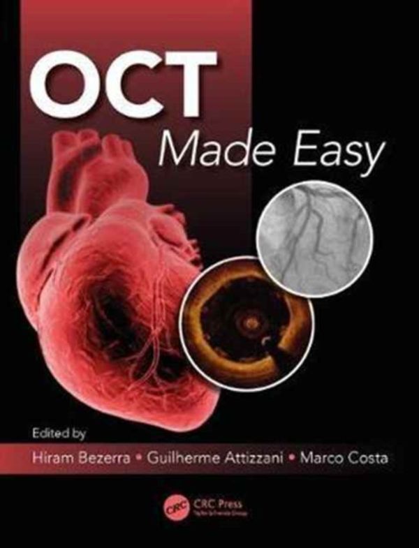 Cover Art for 9781498714563, OCT Made Easy by 
