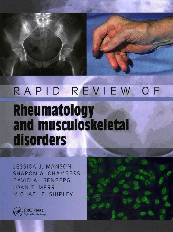 Cover Art for 9781840760941, Rapid Review of Rheumatology and Musculoskeletal Disorders by Jessica Manson, David Isenberg, Sharon Chambers, Michael Shipley, Joan Merrill