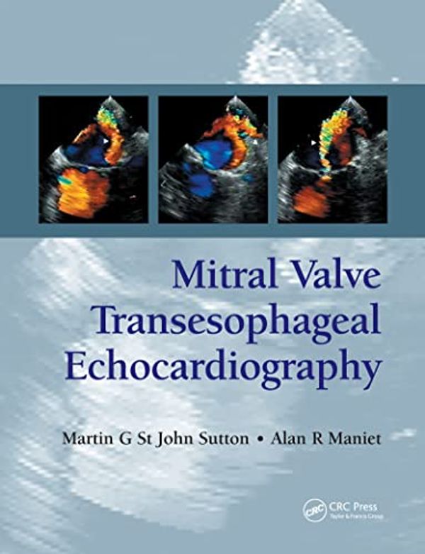 Cover Art for 9781841846088, Mitral Valve Transesophageal Echocardiography by Martin G. St. John Sutton