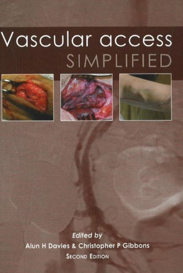 Cover Art for 9781903378526, Vascular Access Simplified by Alun H. Davies, Christopher P. Gibbons