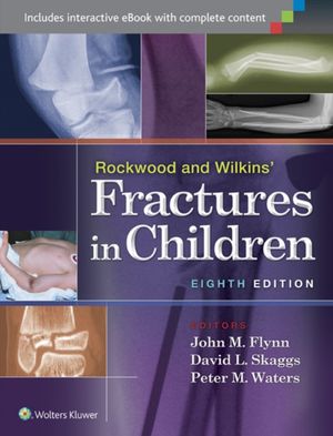 Cover Art for 9781451143935, Rockwood and Wilkins' Fractures in Children by John M. Flynn