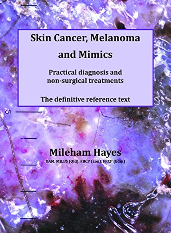 Cover Art for 9780987234353, Skin Cancer, Melanoma and Mimics. Practical diagnosis and non-surgical treatments by Mileham Hayes