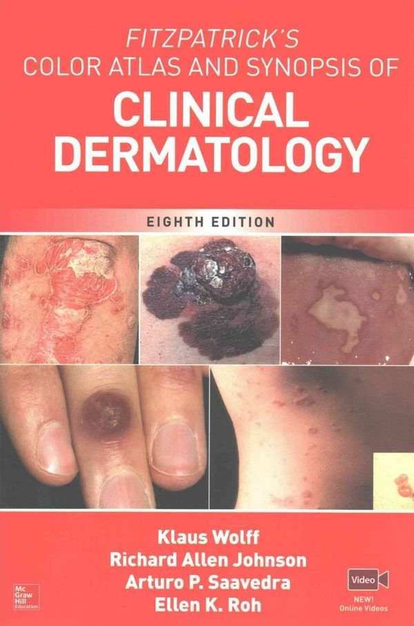 Cover Art for 9781259642197, Fitzpatrick's Color Atlas and Synopsis of Clinical Dermatology, Eighth Edition by Klaus Wolff