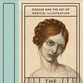 Cover Art for 8601410605537, The Sick Rose: Disease and the Art of Medical Illustration by Richard Barnett