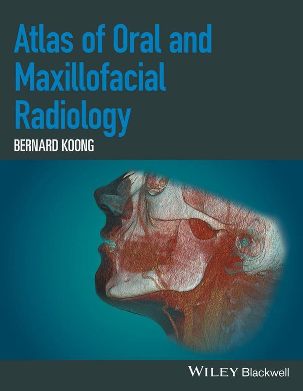 Cover Art for 9781118939628, Atlas of Oral and Maxillofacial Radiology by Bernard Koong