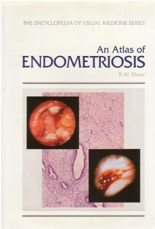 Cover Art for 9781850703907, An Atlas of Endometriosis by Robert W. Shaw