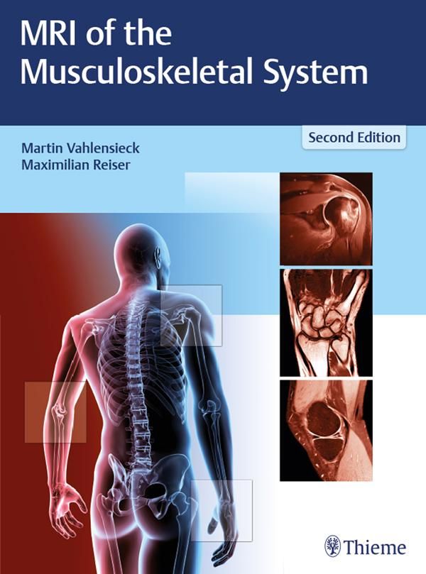 Cover Art for 9783131607928, MRI of the Musculoskeletal System by Martin Vahlensieck, Maximilian Reiser