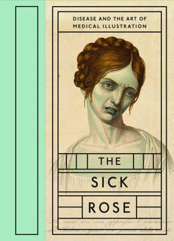 Cover Art for 9781938922404, The Sick Rose: Disease and the Art of Medical Illustration by Richard Barnett