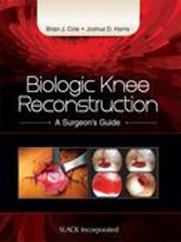 Cover Art for 9781630912130, Biologic Knee ReconstructionA Surgeon's Guide by Brian Cole