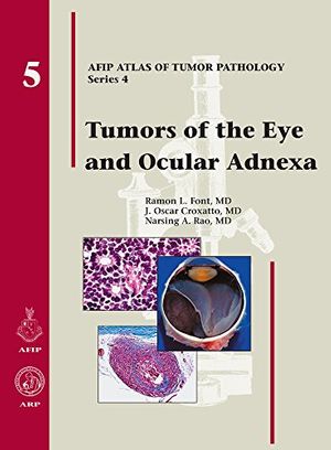 Cover Art for 9781881041993, Tumors of the Eye and Ocular Adnexa by Ramon L. Font