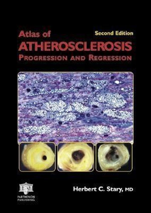 Cover Art for 9780203490709, Atlas of Atherosclerosis: Progression and Regression by Herbert C Stary