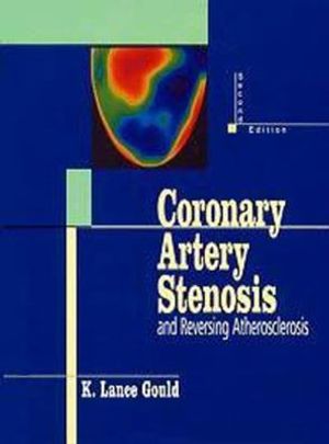 Cover Art for 9780412091414, Coronary Artery Stenosis by K. Lance, M.D. Gould