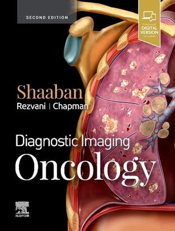 Cover Art for 9780323661126, Diagnostic Imaging: Oncology by Akram M. Shaaban