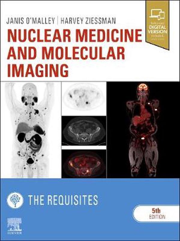 Cover Art for 9780323530378, Nuclear Medicine and Molecular Imaging: The Requisites (Requisites in Radiology) by O'Malley MD, Janis P., Ziessman MD, Harvey A.