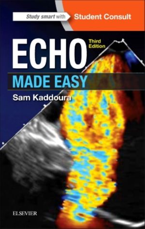 Cover Art for 9780702066566, Echo Made Easy, 3e by Sam Kaddoura