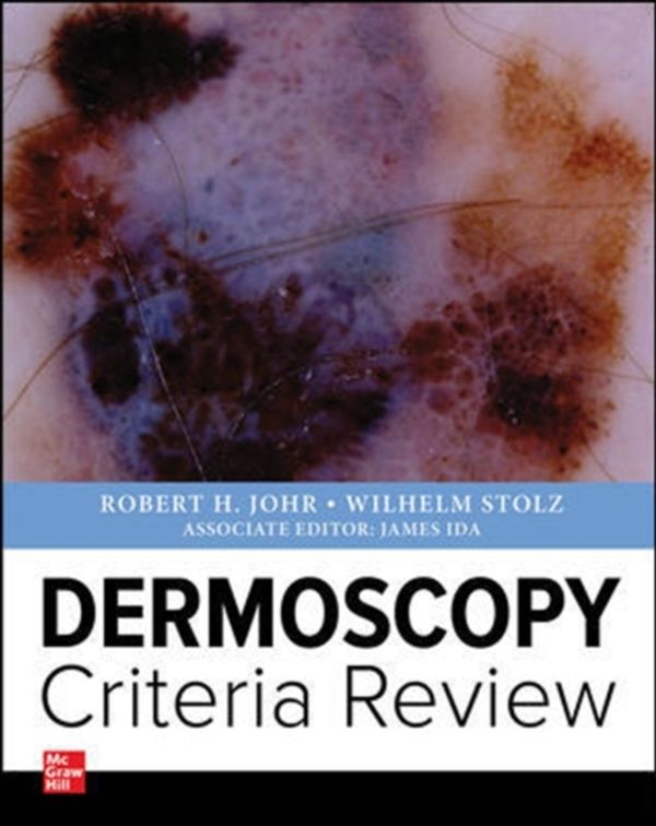 Cover Art for 9781260136241, Dermoscopy  Criteria Review by Robert Johr