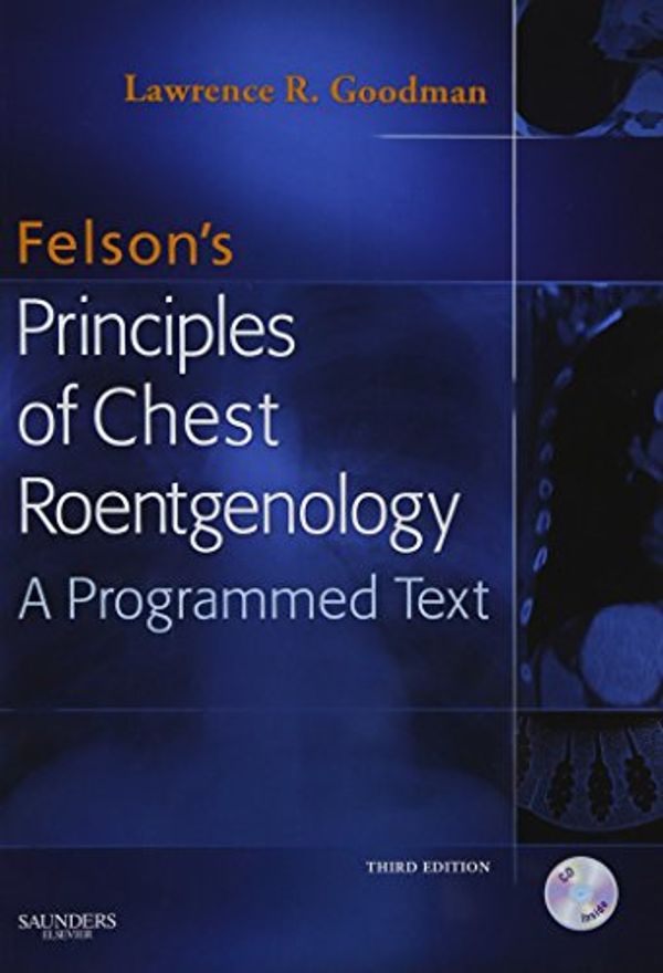 Cover Art for 9781416029236, Felson's Principles of Chest Roentgenology by Goodman MD FAAC, Lawrence R.