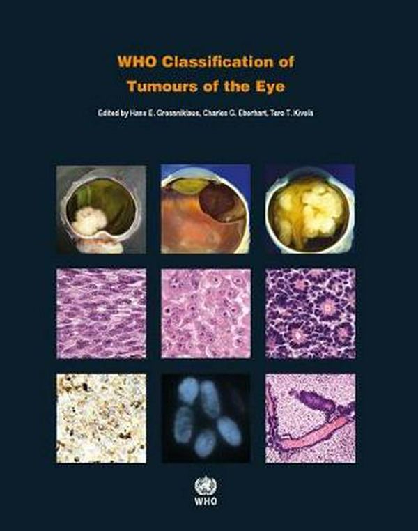Cover Art for 9789283244974, Who Classification of Tumours of the Eye (IARC Who Classification of Tumours) by International Agency for Research on Cancer