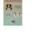 Cover Art for 9780801681257, Human Brain in Photographs and Diagrams by John Nolte, Jay B. Angevine, Jay Angevine