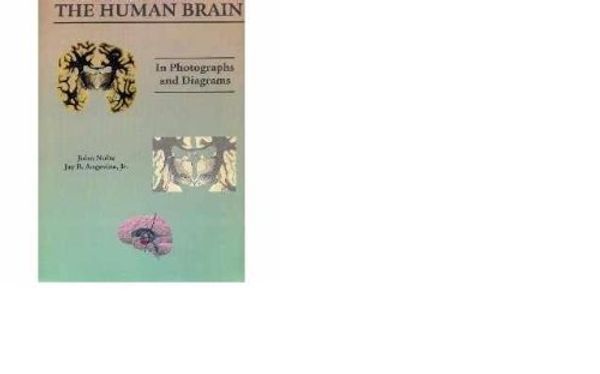 Cover Art for 9780801681257, Human Brain in Photographs and Diagrams by John Nolte, Jay B. Angevine, Jay Angevine