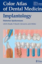 Cover Art for 9783131002310, Implantology by Hubertus Spiekermann