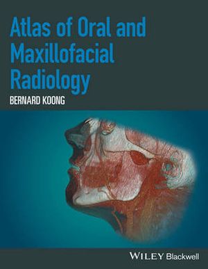 Cover Art for 9781118939642, Atlas of Oral and Maxillofacial Radiology by Bernard Koong