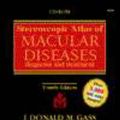 Cover Art for 9780323007054, Stereoscopic Atlas of Macular Diseases by J.d.m. Gass