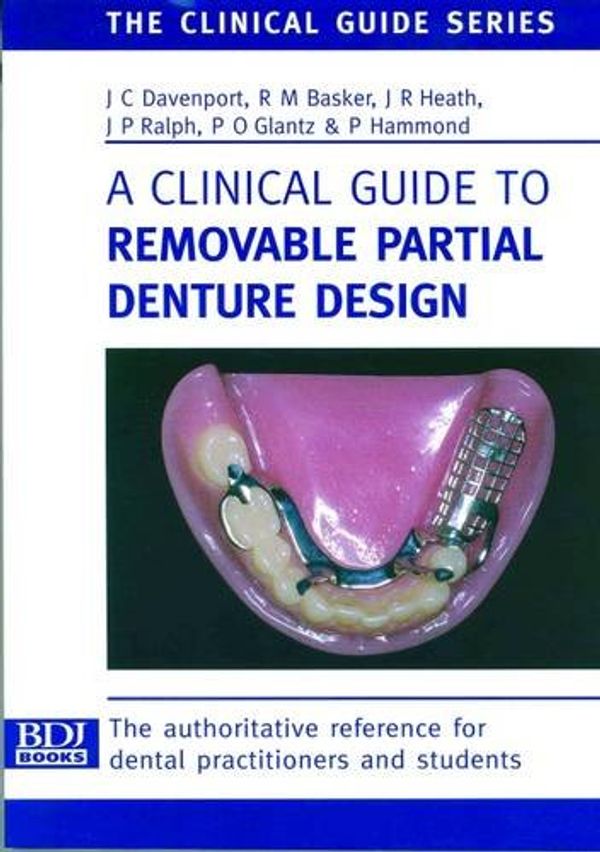 Cover Art for 9780904588637, A Clinical Guide to Removable Partial Denture Design by J.C. Davenport