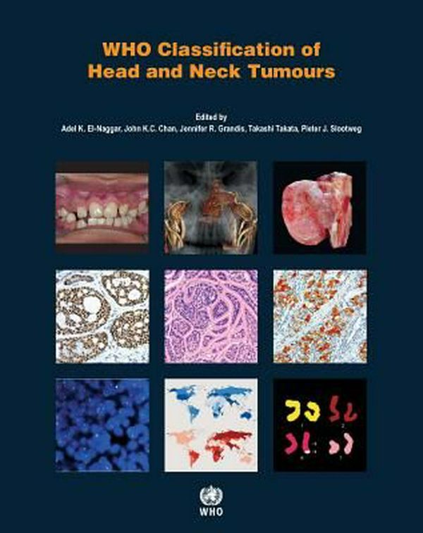 Cover Art for 9789283224389, Who Classification of Head and Neck TumoursIARC Who Classification of Tumours by International Agency for Research on Cancer