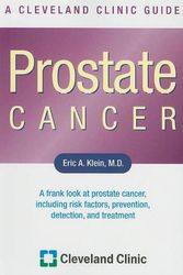 Cover Art for 9781596240865, Prostate Cancer: A Cleveland Clinic Guide (Cleveland Clinic Guides) by Eric A Klein