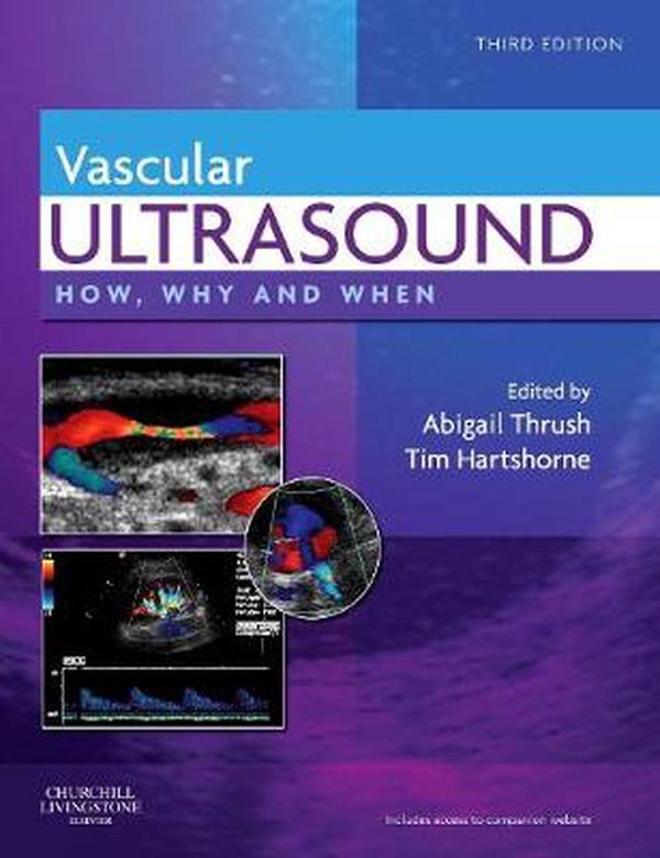 Cover Art for 9780443069185, Vascular Ultrasound by Abigail Thrush, Timothy Hartshorne