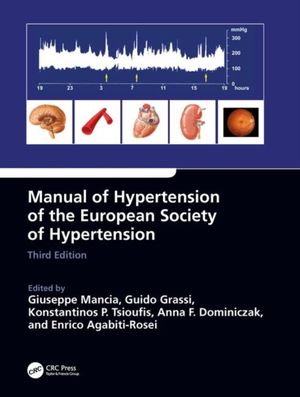 Cover Art for 9780815378747, Manual of Hypertension of the European Society of Hypertension, Third Edition by Anna Dominiczak