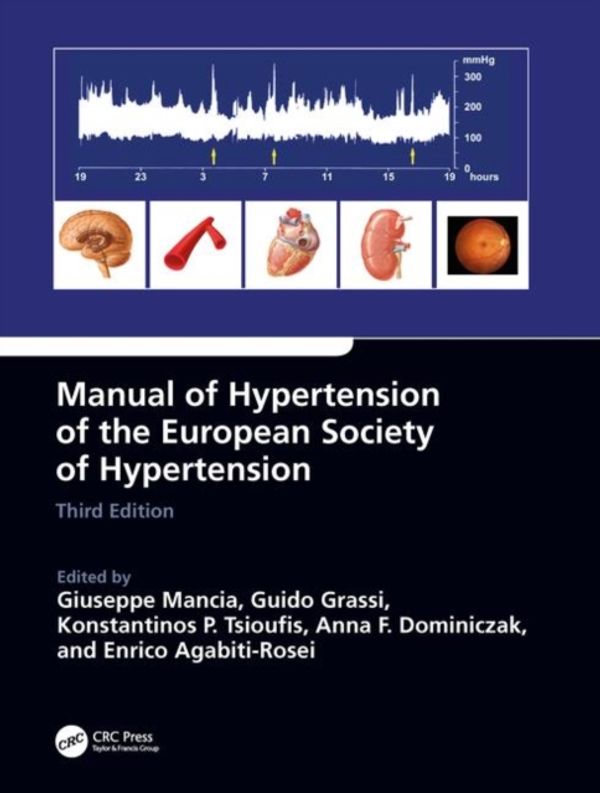 Cover Art for 9780815378747, Manual of Hypertension of the European Society of Hypertension, Third Edition by Anna Dominiczak