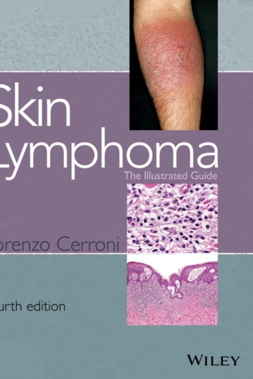 Cover Art for 9781118492499, Skin Lymphoma by Lorenzo Cerroni