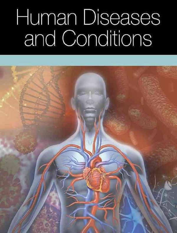 Cover Art for 9780684325200, Human Diseases and ConditionsHuman Diseases and Conditions by Miranda Herbert Ferrara