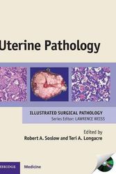Cover Art for 9780521509800, Uterine pathology : Cambridge illustrated surgical pathology by Robert Soslow