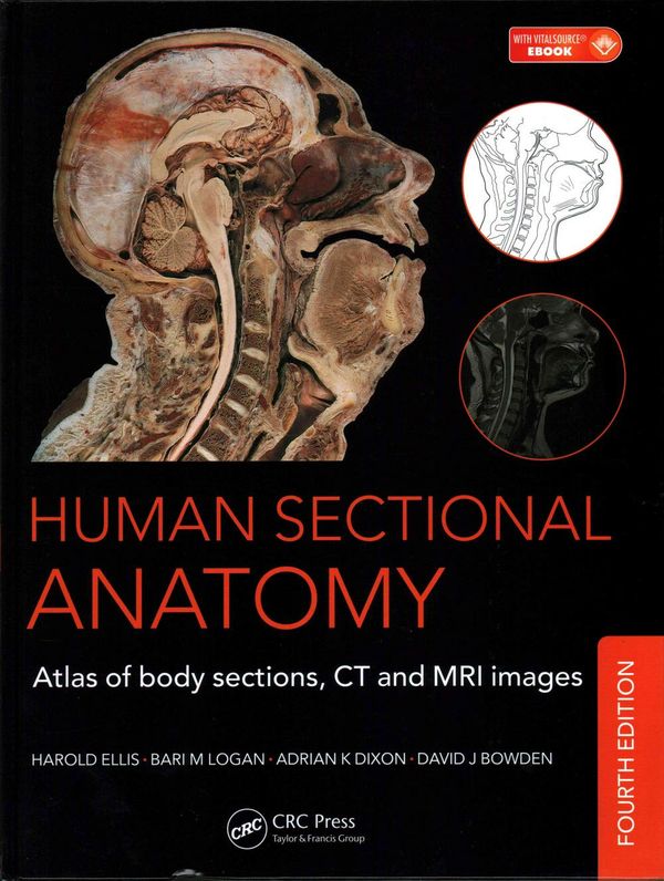 Cover Art for 9781498703604, Human Sectional Anatomy: Atlas of Body Sections,CT and MRI Images, Fourth Edition by Adrian K. Dixon, David J. Bowden, Harold Ellis, Bari M. Logan
