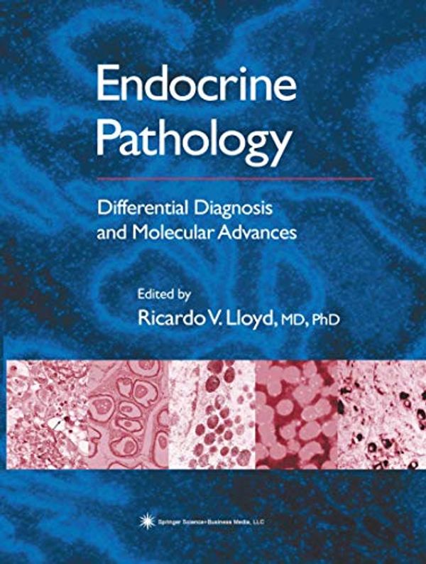 Cover Art for 9781617374234, Endocrine Pathology by 