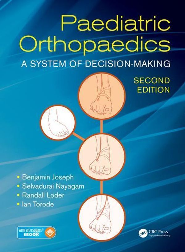 Cover Art for 9781498708449, Paediatric Orthopaedics: A System of Decision-Making, Second Edition by Benjamin Joseph