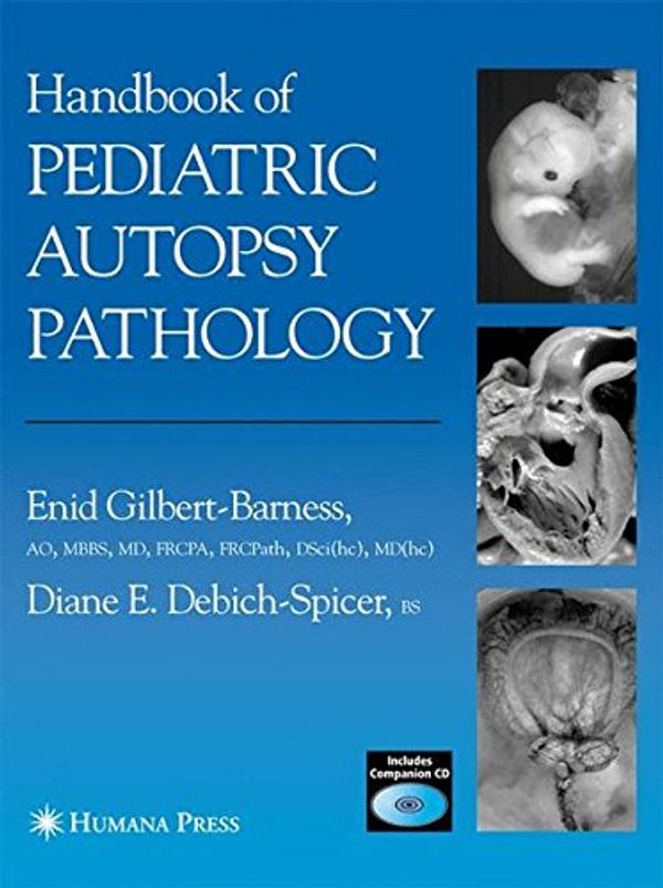 Cover Art for 9781617374333, Handbook of Pediatric Autopsy Pathology by Gilbert-Barness, Enid, Debich-Spicer, Diane E.