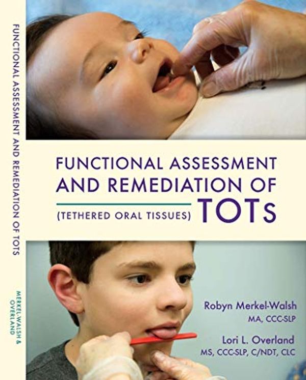 Cover Art for B07JN788BX, Tongue-Tied: Functional Assessment and Remediation of TOTs (Tethered Oral Tissues) by Unknown