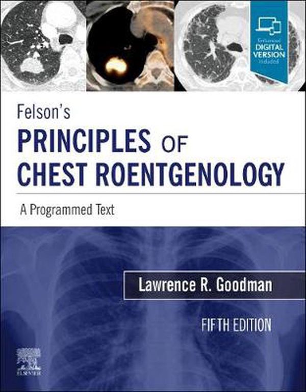 Cover Art for 9780323625678, Felson's Principles of Chest Roentgenology: A Programmed Text by Goodman MD FAAC, Lawrence R.