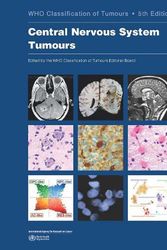 Cover Art for 9789283245087, Central Nervous System Tumours: 6 by International Agency for Research on Cancer
