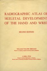 Cover Art for 9780804703987, Radiographic Atlas of Skeletal Development of Hand and Wrist by S. Idell Pyle, William Walter Greulich