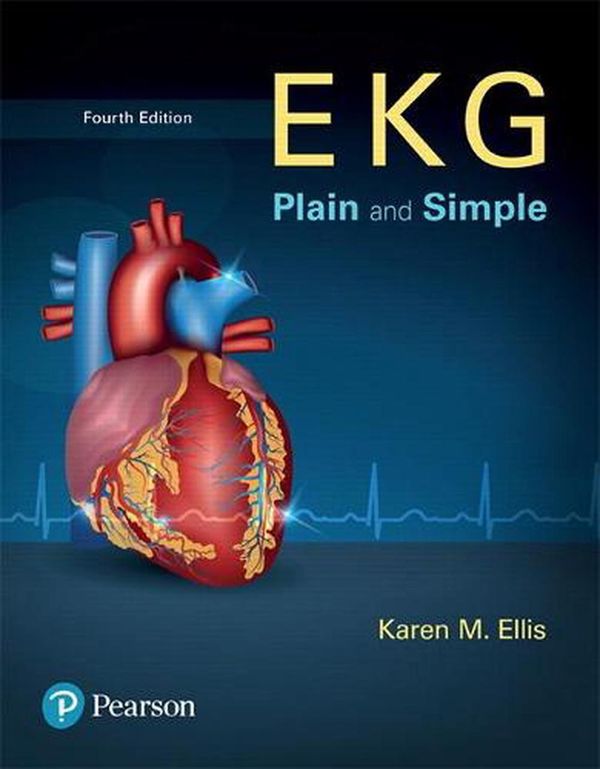 Cover Art for 9780134525051, EKG Plain and Simple by Karen Ellis