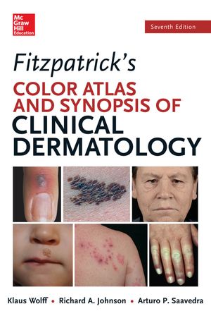 Cover Art for 9780071793032, Fitzpatricks Color Atlas and Synopsis of Clinical Dermatology, Seventh Edition by Klaus Wolff, Richard Johnson, Arturo Saavedra