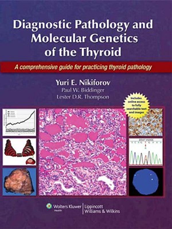 Cover Art for 9780781774598, Diagnostic Pathology and Molecular Genetics of the Thyroid by Yuri E. Nikiforov