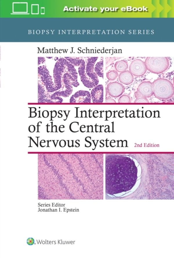Cover Art for 9781496382634, Biopsy Interpretation of the Central Nervous System by Matthew Schniederjan